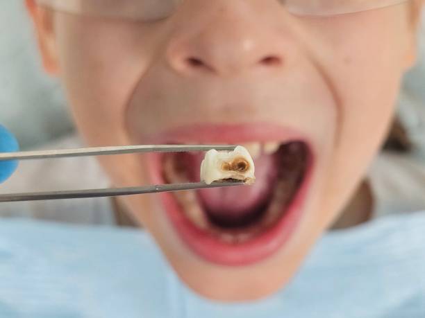 Best Same-Day Emergency Dentist in Monticello, MN